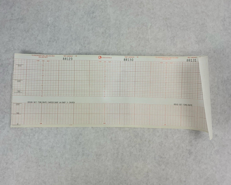Corometrics 155 Fetal Monitor - Partially Tested