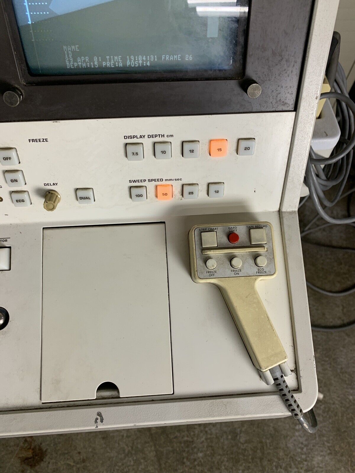 Philips SDC 4000 Ultrasound Machine Power Tested