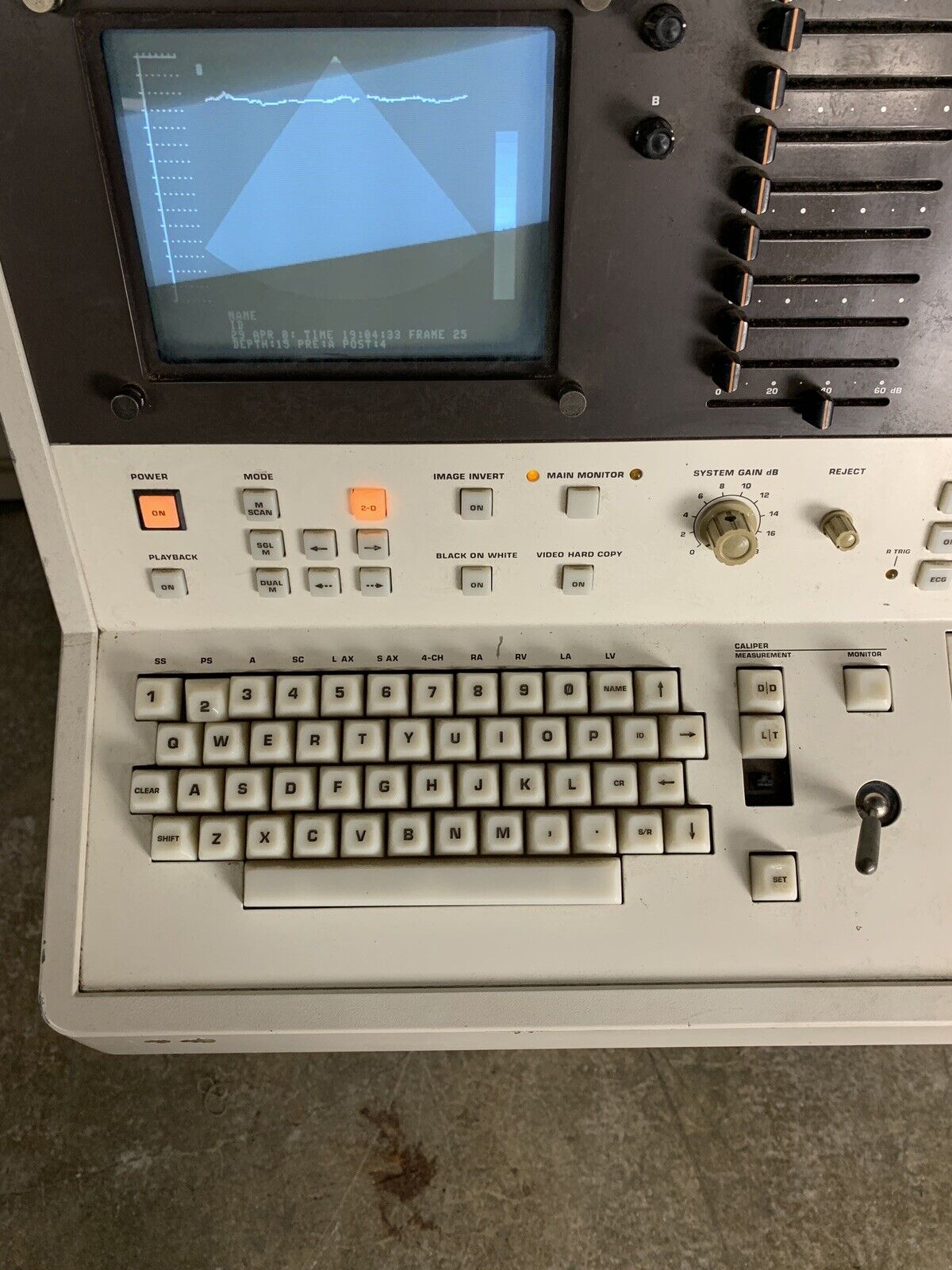 Philips SDC 4000 Ultrasound Machine Power Tested