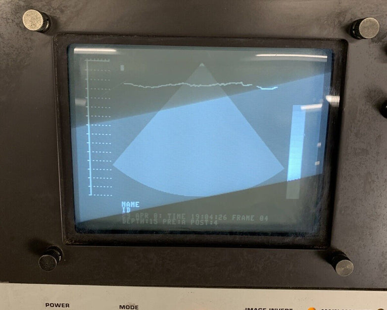 Philips SDC 4000 Ultrasound Machine Power Tested