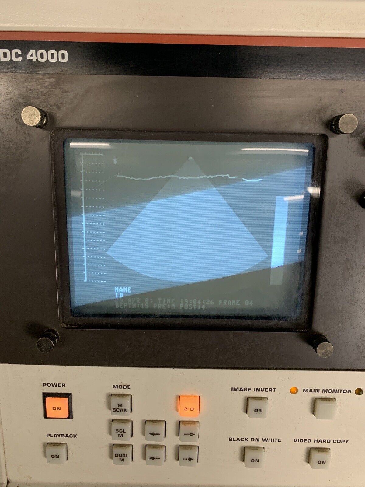 Philips SDC 4000 Ultrasound Machine Power Tested