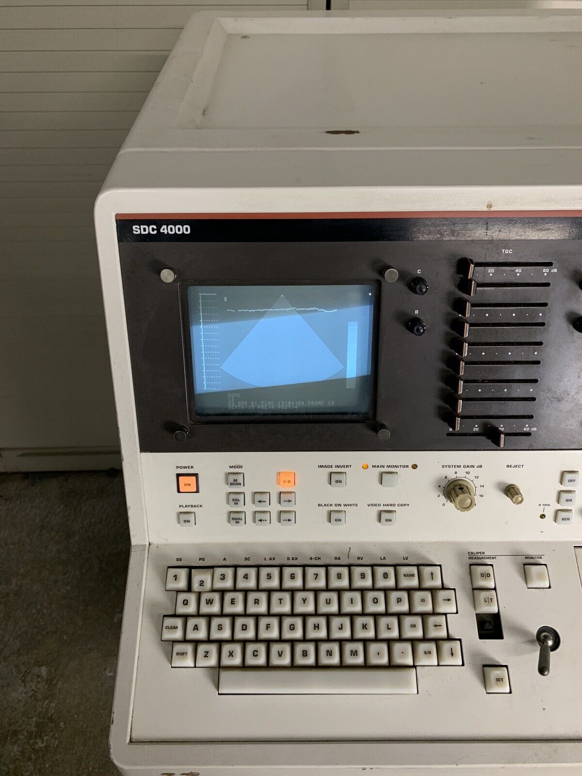 Philips SDC 4000 Ultrasound Machine Power Tested