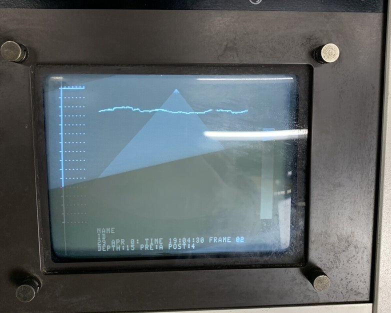 Philips SDC 4000 Ultrasound Machine Power Tested