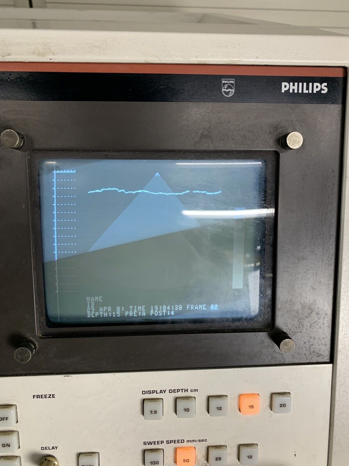 Philips SDC 4000 Ultrasound Machine Power Tested